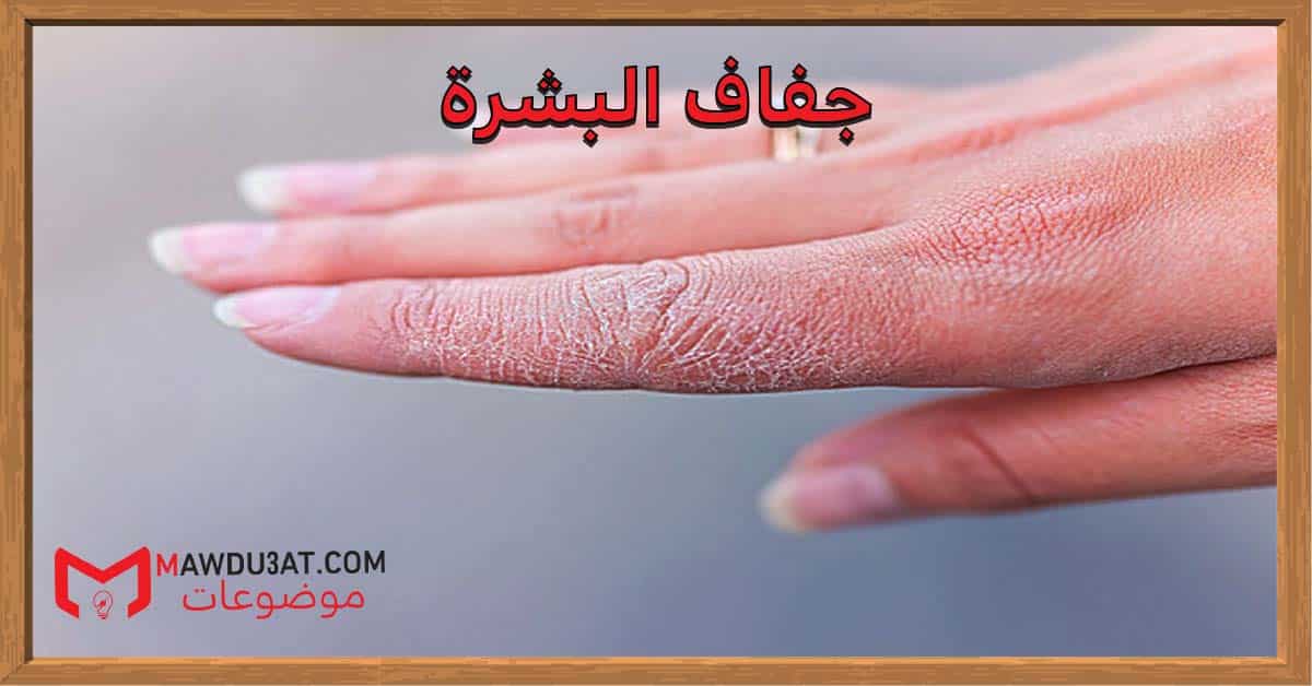 جفاف البشرة: كيفية التخلص من جفاف البشرة في الشتاء؟ – موضوعات